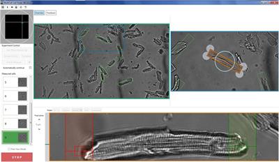 Approaches to High-Throughput Analysis of Cardiomyocyte Contractility